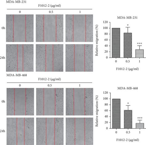 F Inhibits Mda Mb And Mda Mb Cell Migration And Invasion