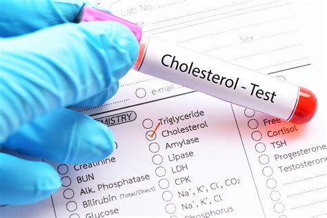 Understand Cholesterol Testing - Testing.com