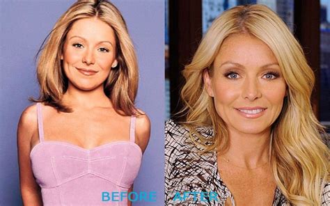 Kelly Ripa before and after plastic surgery (20) – Celebrity plastic surgery online