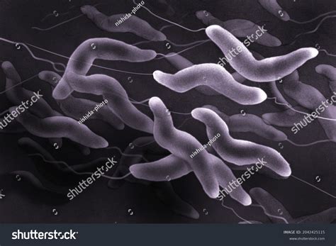 Image Campylobacter Viewed Under Microscope Stock Illustration ...