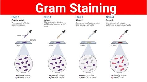 Ziehl-Neelsen Stain (ZN-Stain) Principle, Procedure,, 59% OFF