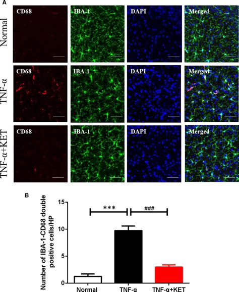 Ketamine suppressed TNFαinduced microglia activation in hippocampus