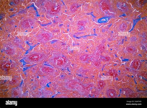 Spleen Light Micrograph Stock Photo Alamy