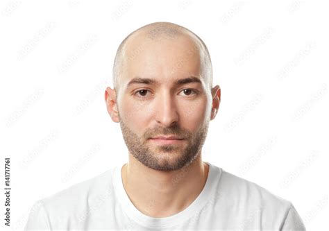 Hair loss concept. Portrait of young bald man on white background Stock ...