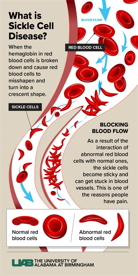 Gene Therapy What To Know About The New FDA Approved Treatment For