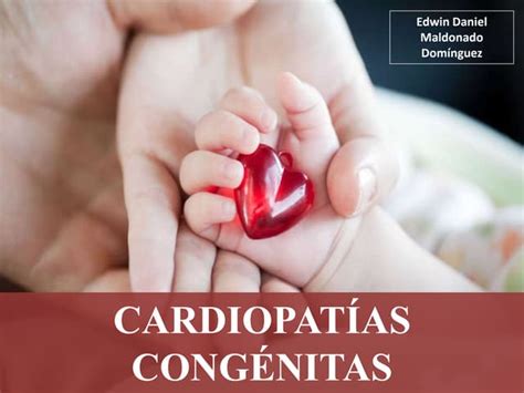 Cardiopatías Congénitas Resumen De Las Más Importantes Ppt