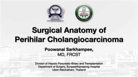 Surgical anatomy of perihilar cholangiocarcinoma; Surgeon's Perspective (THAI version) - YouTube