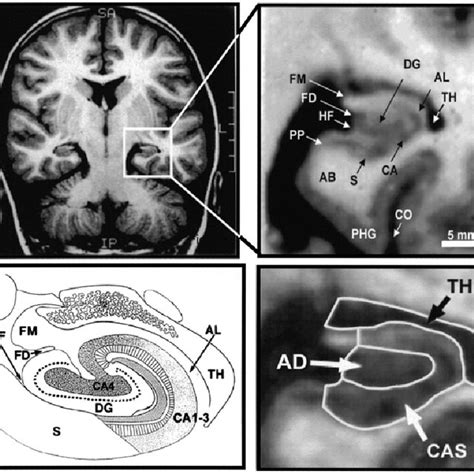 [PDF] Development of the hippocampal formation from 2 to 42 years: MRI ...