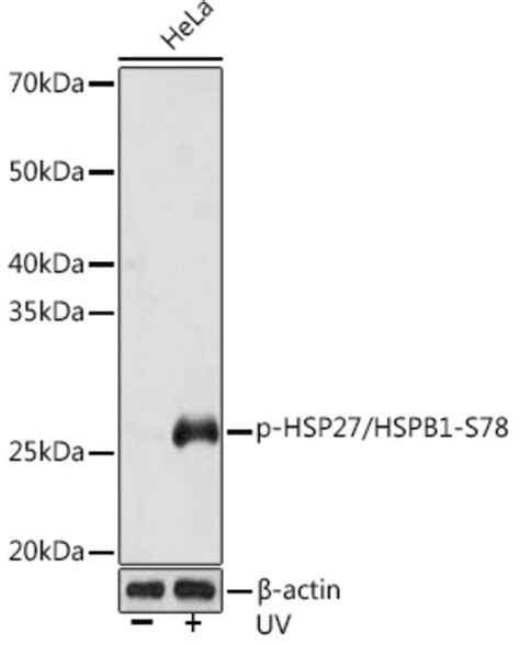 Anti Phospho HSP27 HSPB1 S78 Antibody Produced In Rabbit