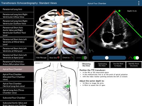 TTE Standard Views by University Health Network