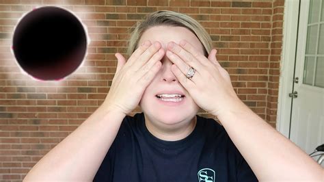 Eye Damage From Solar Eclipse Youtube