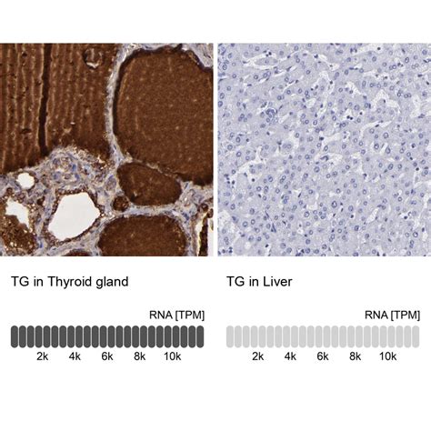 Rabbit Polyclonal Anti-TG Antibody - Buy for research - Highly specific ...