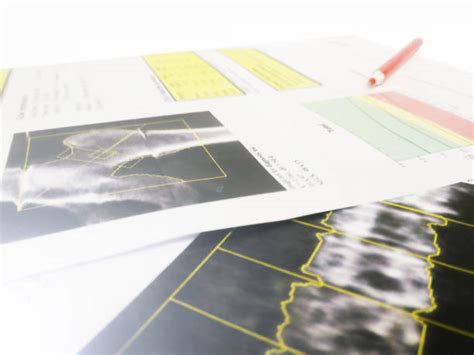 bone density scan stock  pictures royalty  images istock