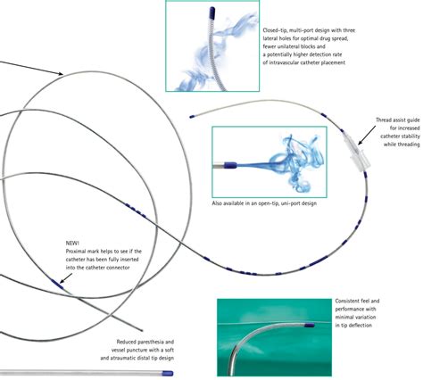 Epidural Catheter Nysora At Jason Hutchison Blog