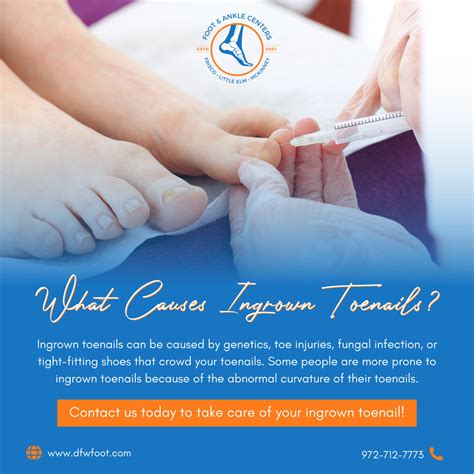 What Causes Ingrown Toenails In Frisco Little Elm And Mckinney Tx