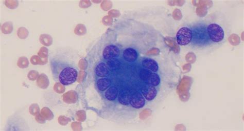 Clinical Pathology Exam Cytopathology Key Points Flashcards Quizlet