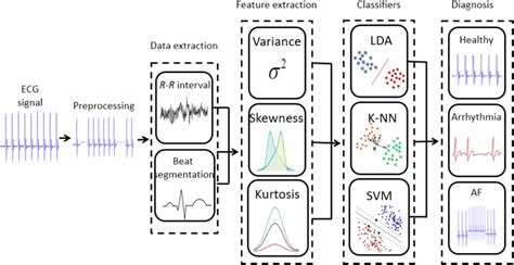 Block Diagram Of The Segmentation And Classification Of Ecg Signals