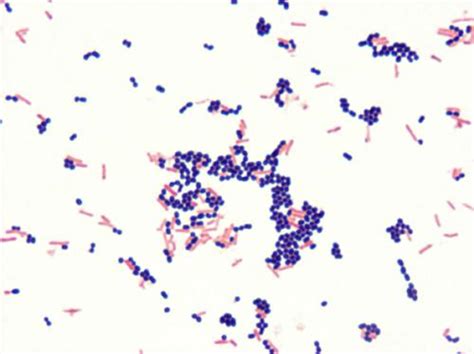 Streptococcus Faecalis Gram Stain