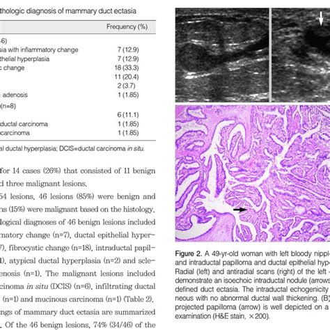 A 44 Yr Old Woman Without Symptom And Moderate To Florid Ductal Download Scientific Diagram