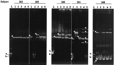 Dgge Pro Fi Les Of The Vaginal Microbiota From Fi Ve Women During The Download Scientific