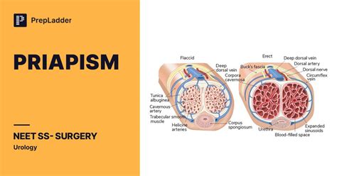 medications   priapism kvbxc