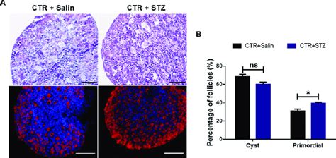 Analysis Of Follicle Development In Newborn Mice Of STZ Induced