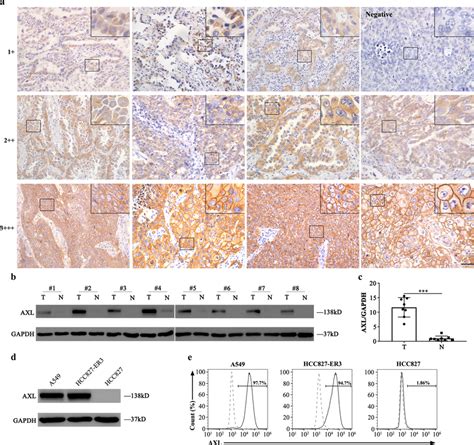 Axl Expression In Human Normal And Nsclc Tissues And Lung Cancer Cell