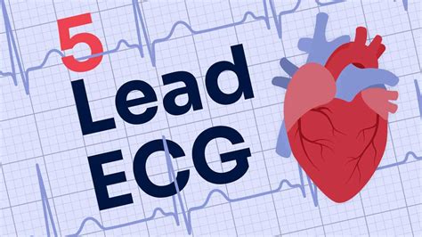 5 Lead ECG Placement And Cardiac Monitoring Ausmed