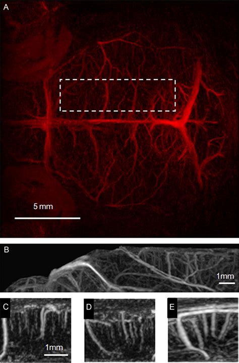 Contrast Enhanced Magnetic Resonance Microangiography Reveals