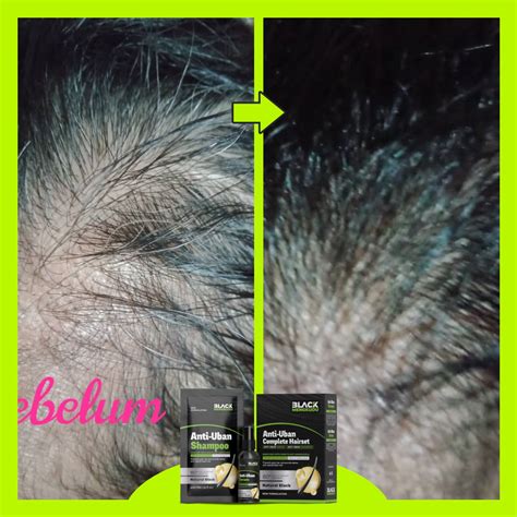 TEMPLATE BEFORE AFTER – Biotin C+