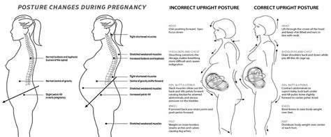 Lordosis Pregnancy