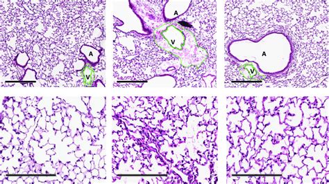 Lung Histology Hematoxylin And Eosin Stained Sections Of Mouse Lungs Download Scientific