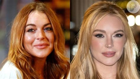 O Que Lindsay Lohan Fez No Rosto Transforma O Radical Da Atriz Choca