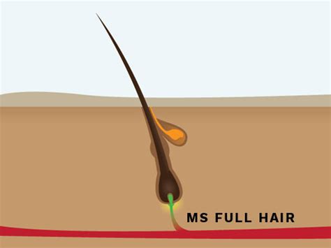 Women's Hair Loss 101: Hair follicle structure and hair growth cycle