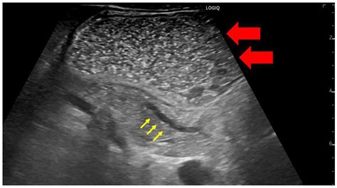 Diagnostics Free Full Text Current Status Of The Diagnosis Of Early