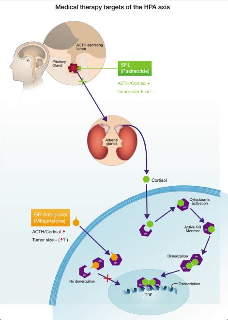 Pasireotide And Mifepristone New Options In The Medical Management Of