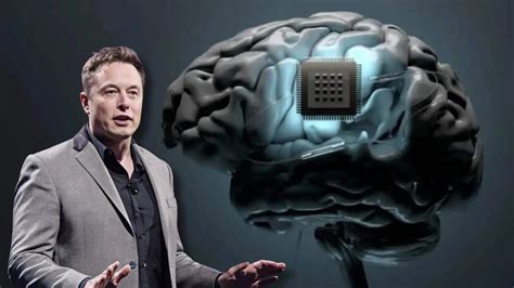 Cómo Funciona Telepathy El Chip Que Elon Musk Quiere Poner En Cabeza De Todos Canal Viax