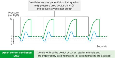 Modes of Ventilation: PEEP, CPAP, A/C and More | Medical Library