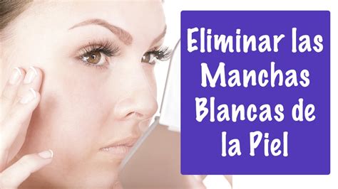 Cómo Quitar Las Manchas Blancas De La Cara En Niños Guía Paso A Paso ...