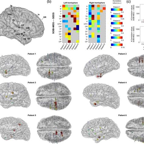 Second‐order Blind Identification Sobimagneto Encephalographic Meg