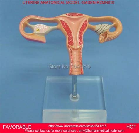 Uterine Anatomy