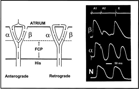 Anatomic Electrophysiological Correlations Concerning The Pathways For Atrioventricular