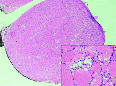 Hematoxylin And Eosin Stained Hande At 2x And 20x Magnification Showing