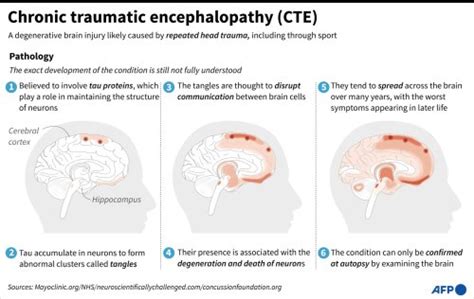 Chronic Traumatic Encephalopathy Cte Flipboard