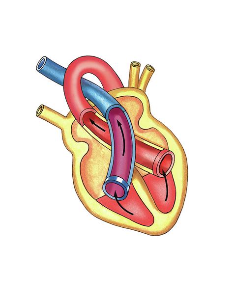 Schema Of Isotonic Systole Photograph By Asklepios Medical Atlas Fine