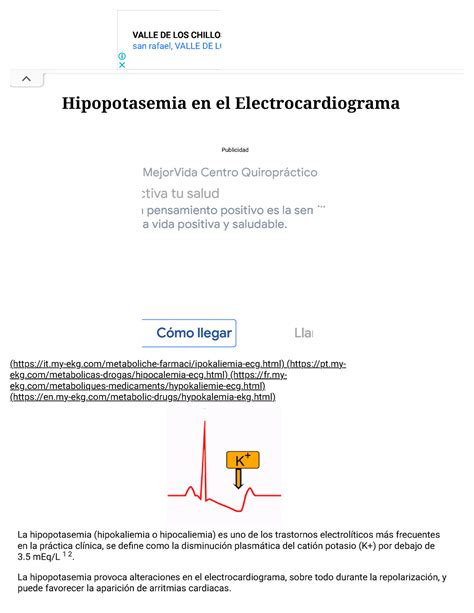 Hipopotasemia En El Electrocardiograma It My Ekg Metaboliche Farmaci