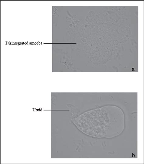 Figure 5 From Identification Of Entamoeba Histolytica Trophozoites In Fresh Stool Sample