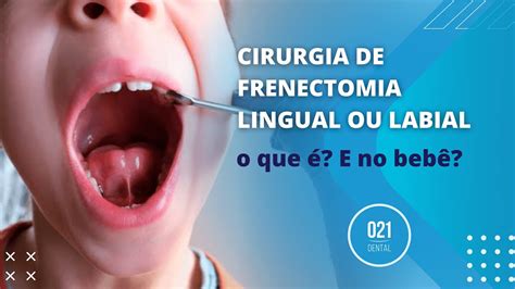 Frenectomia Labial ou Lingual O Que é E no Bebê YouTube