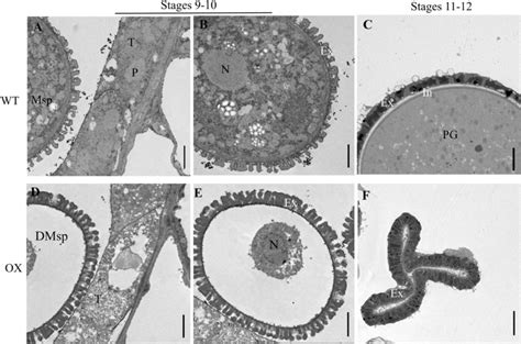 Transmission Electron Micrographs Tem Observation Of The