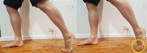 How To Fix Duck Feet Posture Posture Direct